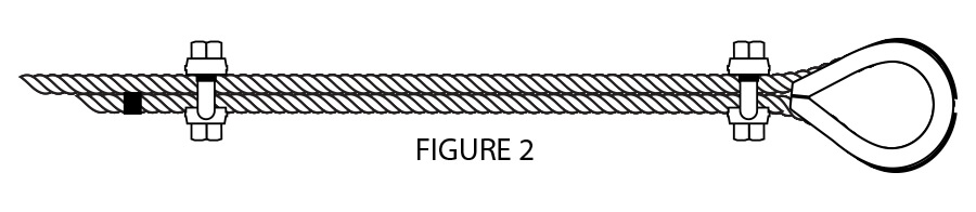 WIRE ROPE TERMINATION RESOURCES Fist Grip